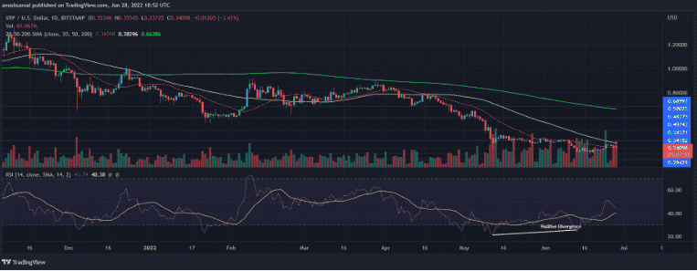 xrp shows